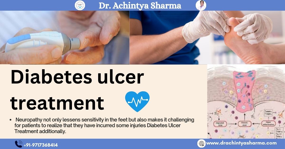Read more about the article “Innovative Approaches to Diabetes Ulcer Treatment”