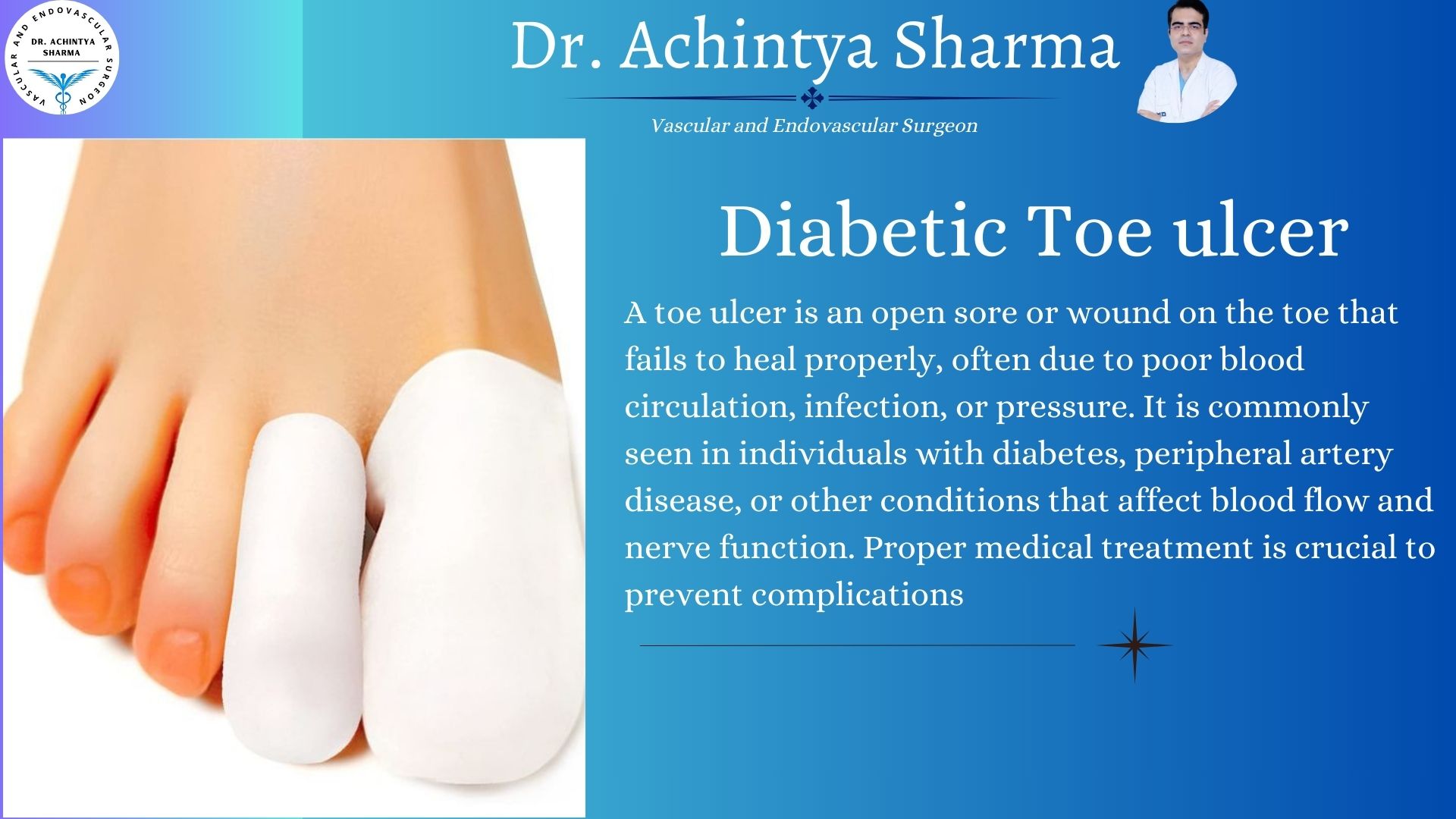 Read more about the article Diabetic Ulcers on Toe: Effective Treatment Options and Prevention Tips