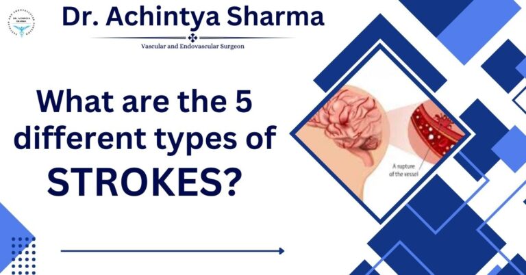 Read more about the article What are the 5 different types of strokes?
