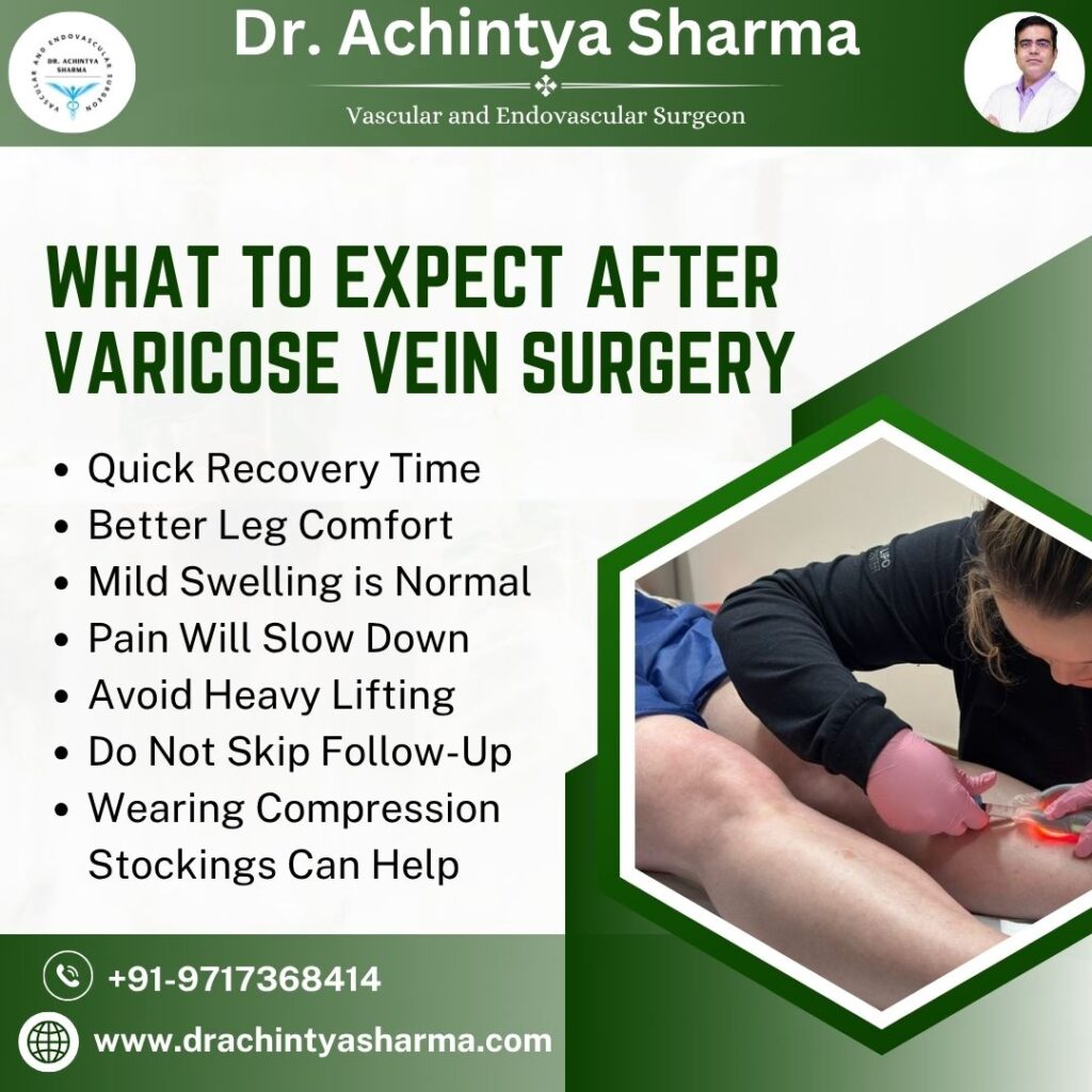 varicose veins